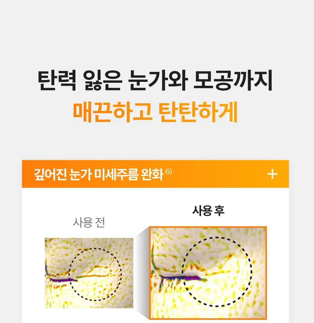 [흔적,기미,미백/TXA] 셀리맥스 트라넥삼산 잡티 크림 35ml 상세페이지 21